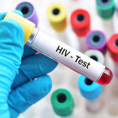 HIV test