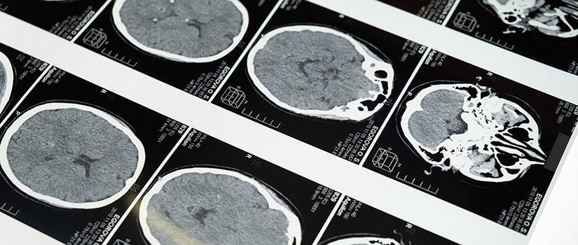 Brain Scan Banner Image