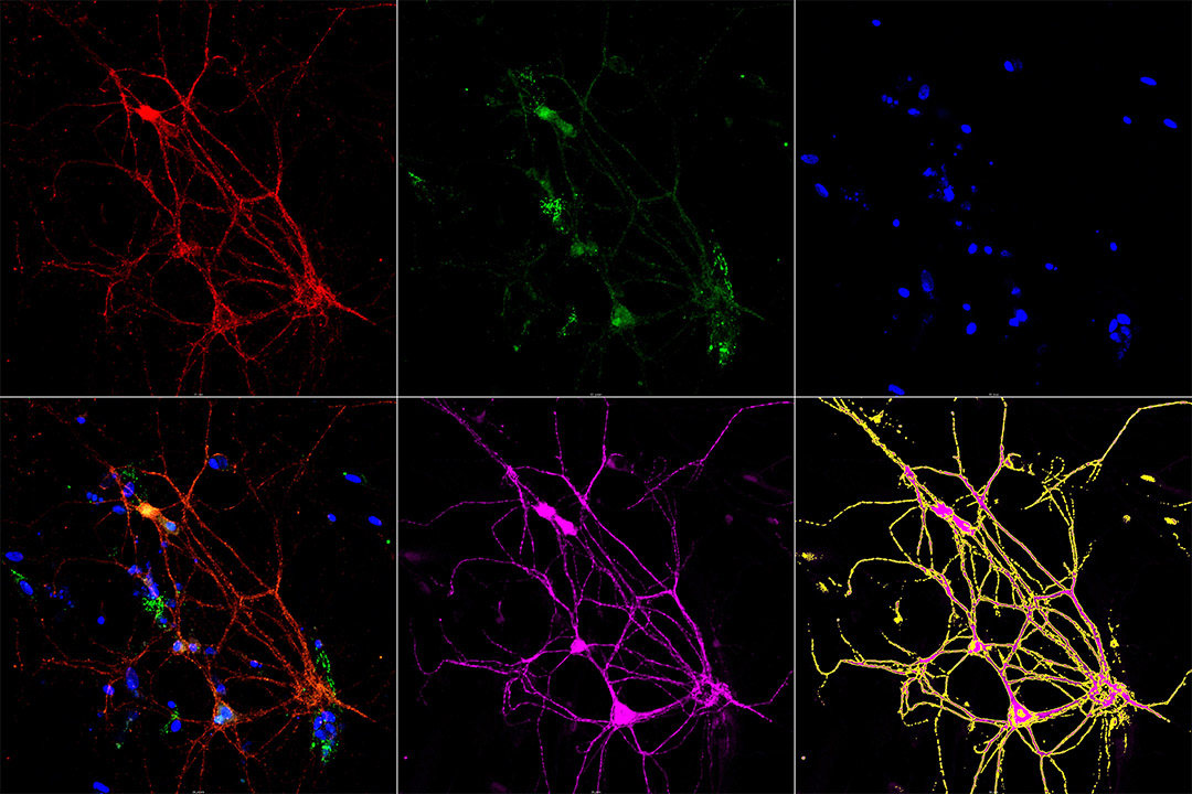 Image of neurons